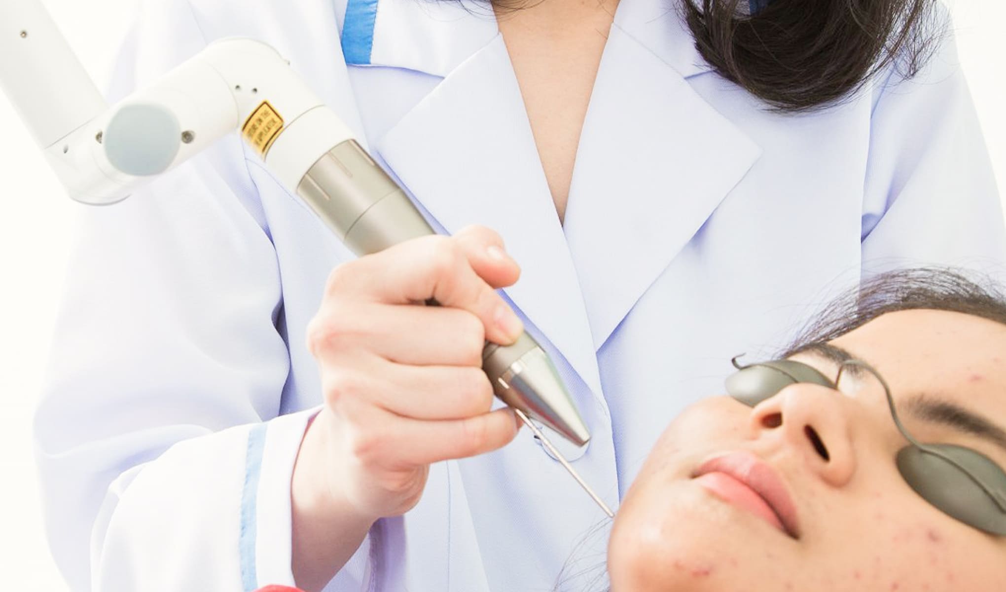 엔디야그 레이저