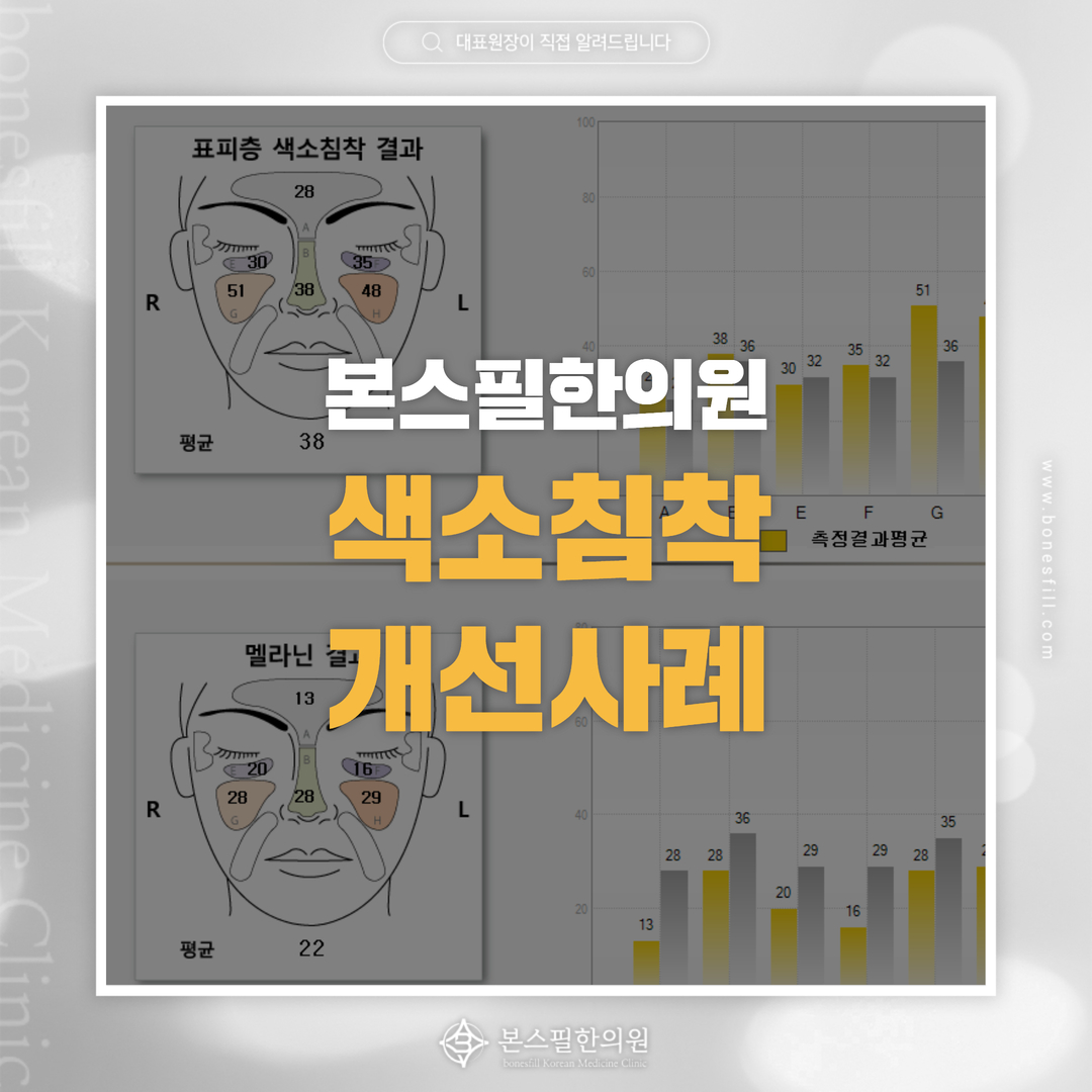 8개월 간의 치료로 색소침착이 개선된 여성 환자분의 사례