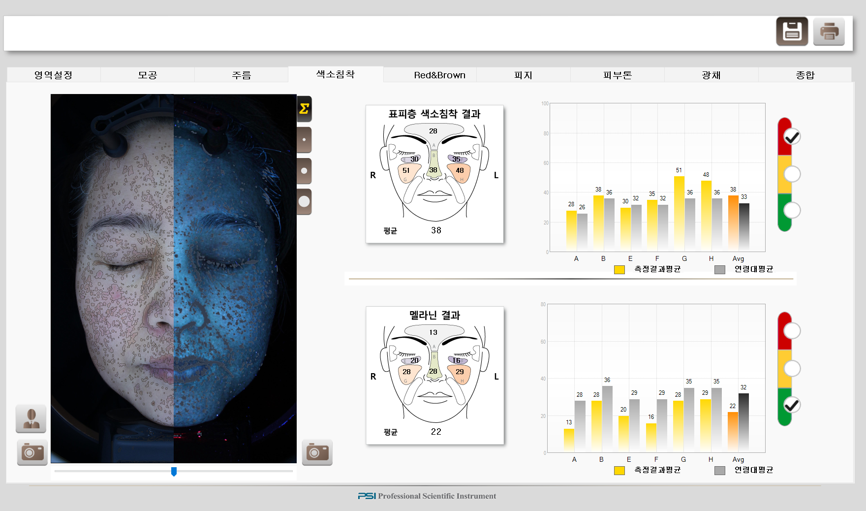 24. 7월 색소 데이터 강은영.bmp