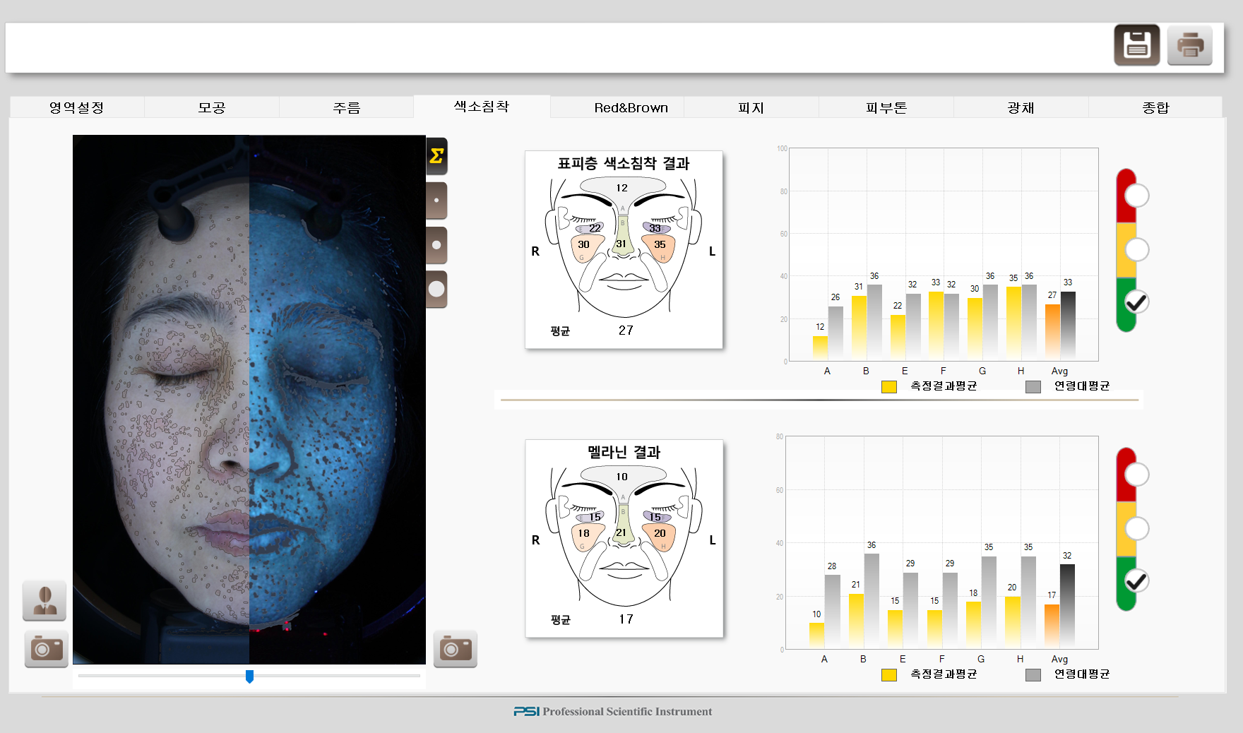 24. 12월 색소 데이터 강은영.bmp