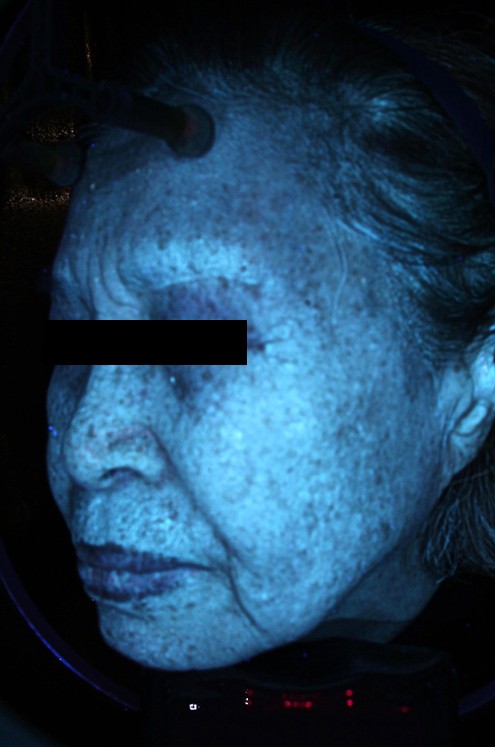 김말연님 25.10 피지 Lt.jpg