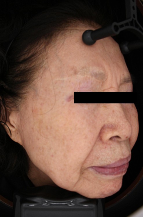 25.10 김말연님 피부톤 Rt.jpg