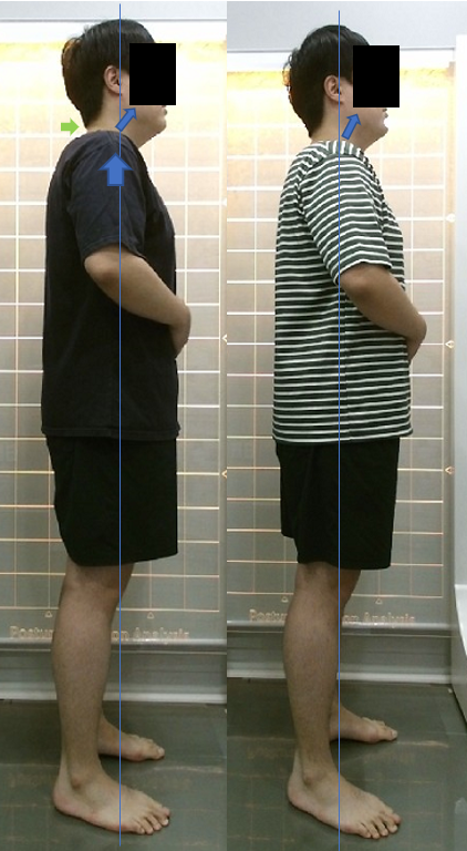 치료 전후 비교.PNG