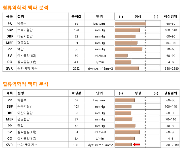 치료전후 맥진분석.PNG