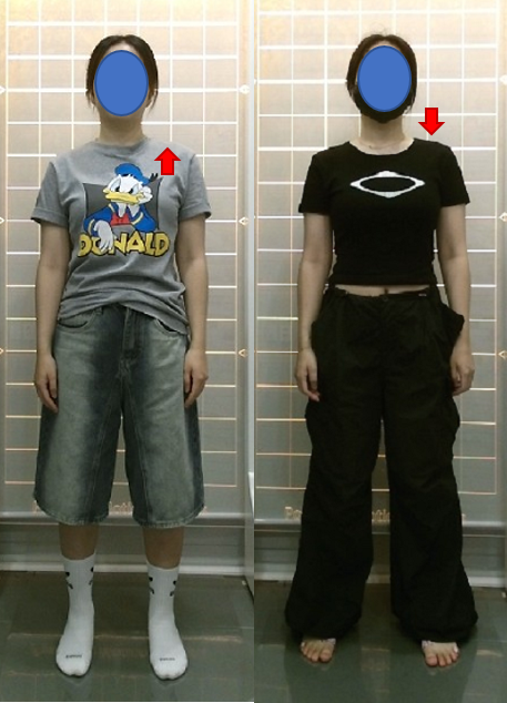 2431 박유진 체형전후.PNG