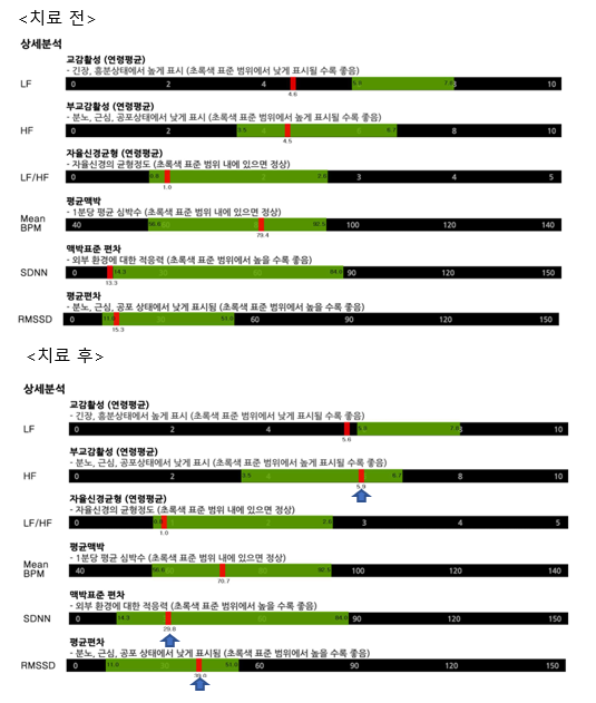 유비오 비교.PNG