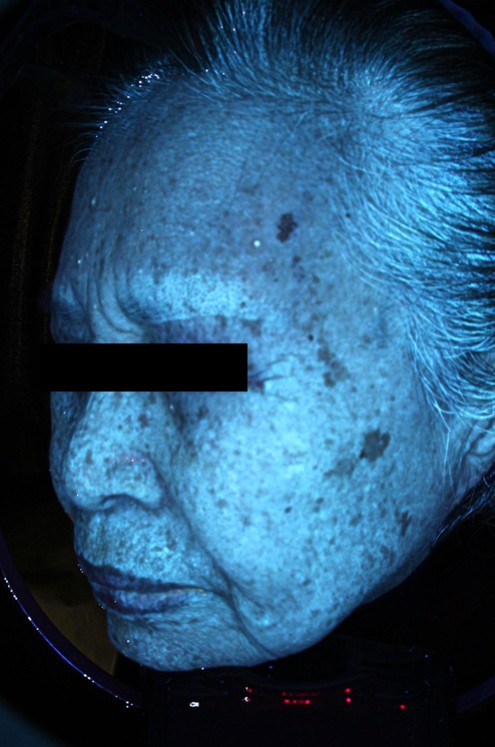 김말연님 25.03 피지 Lt.jpg