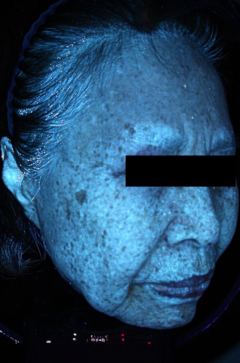 김말연님 25.03 피지 Rt.jpg