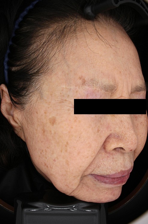 김말연님 25.03 피부톤 Rt.jpg